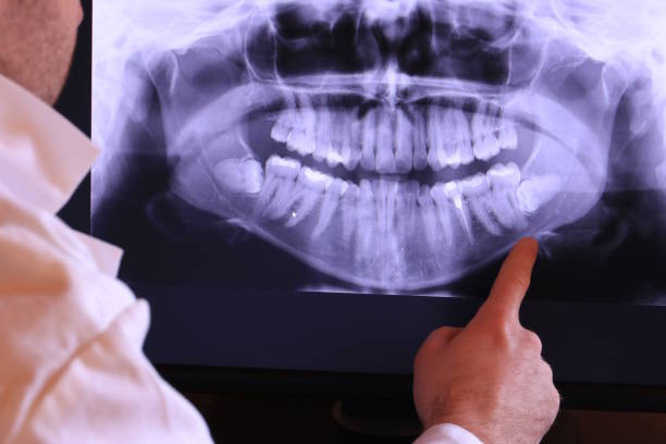 Best Emergency Dentist for Lost Fillings or Crowns in Enterprise, UT