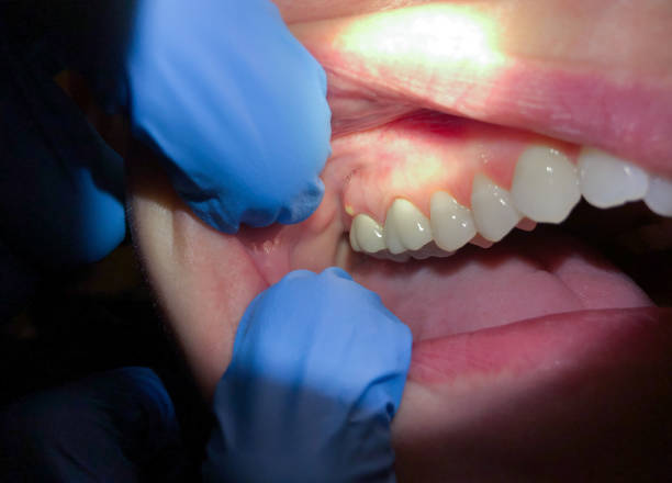 Best Broken or Cracked Tooth Emergency Dentist in Enterprise, UT