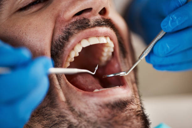 Best Emergency Dental Care for Abscessed Tooth in Enterprise, UT